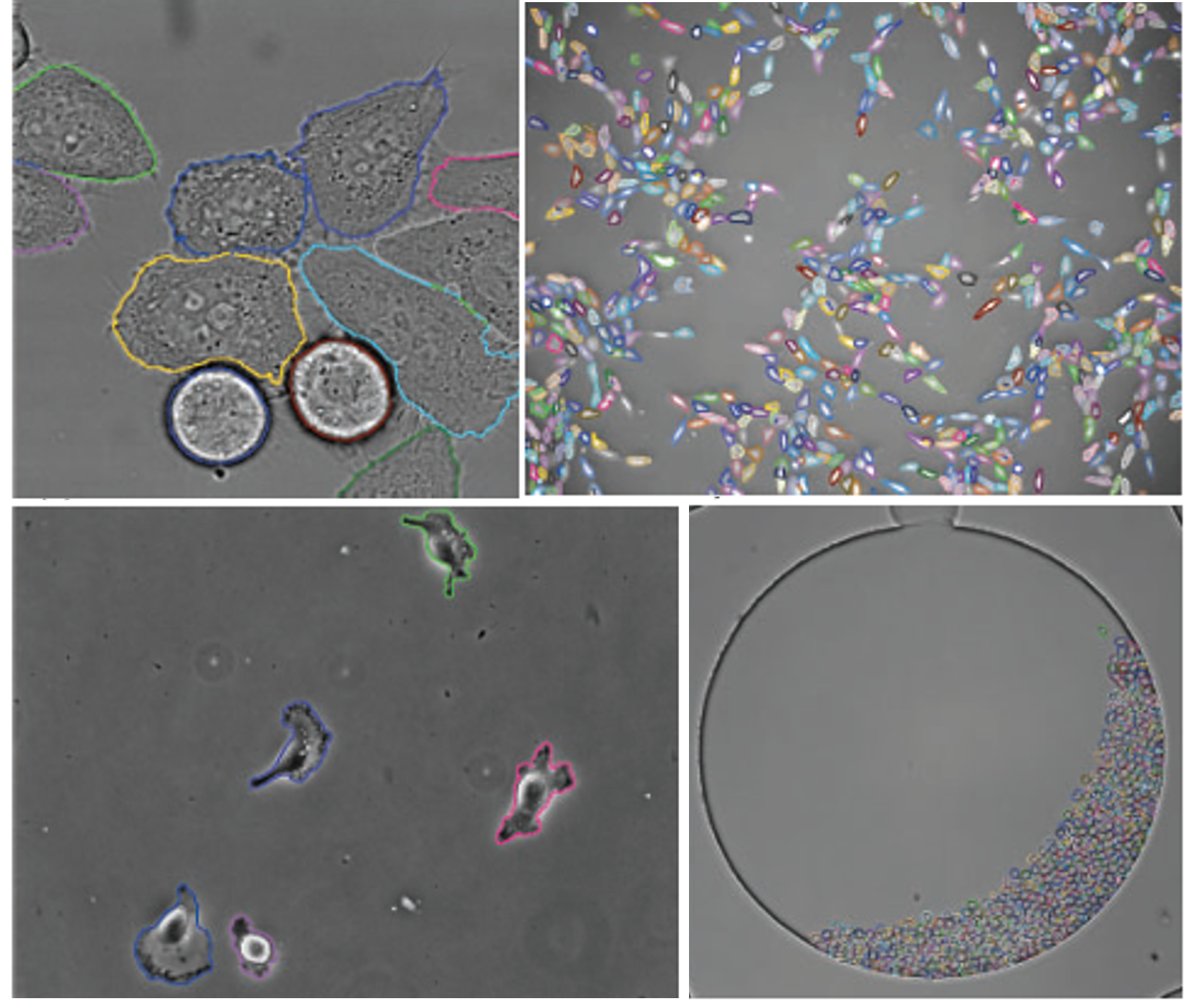 Automatic improvement of deep learning-based cell segmentation in time-lapse microscopy by neural architecture search