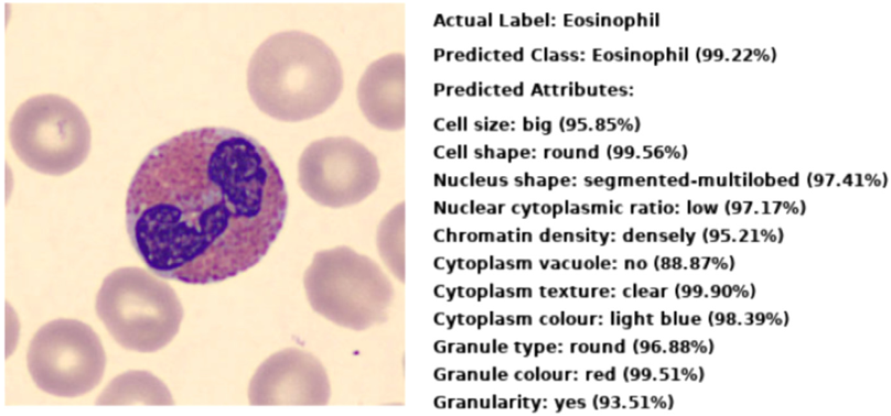 Explainable multimodal hematology analysis for white blood cell classification and attribute prediction