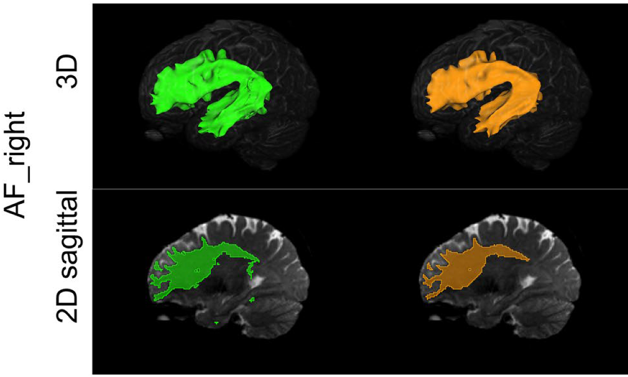 A comparison of manual and automated neural architecture search for white matter tract segmentation